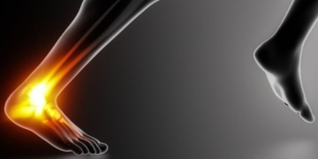 Αχίλλειος τένοντας: Κακώσεις και προστασία