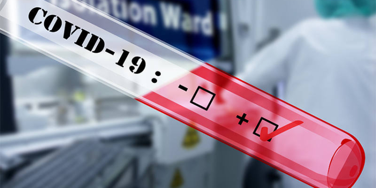 Κορωνοϊός